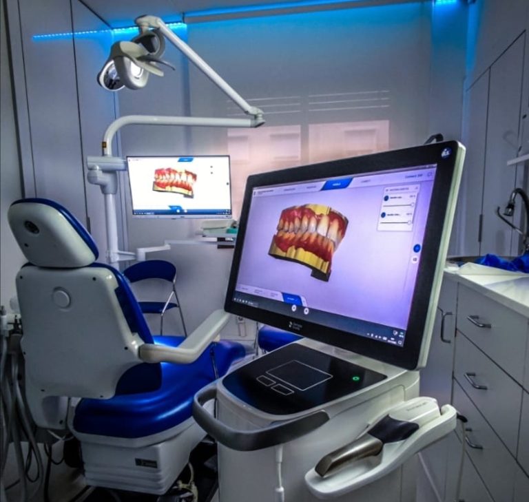 Tecnologia digital escaner 3D